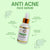 Anti Acne Serum